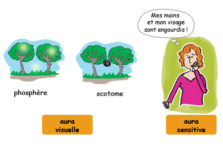 Aura visuelle et aura sensitive